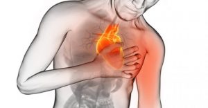 Cardiologista do HCor explica como identificar o AVC, Angina e Infarto