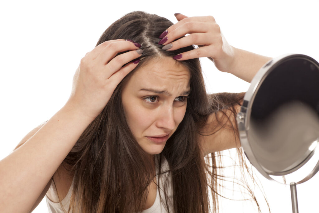 Alopecia de padrão feminino: uma das principais causas de queda de cabelo em mulheres