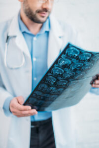 Esclerose múltipla: sintomas diversos podem confundir diagnóstico