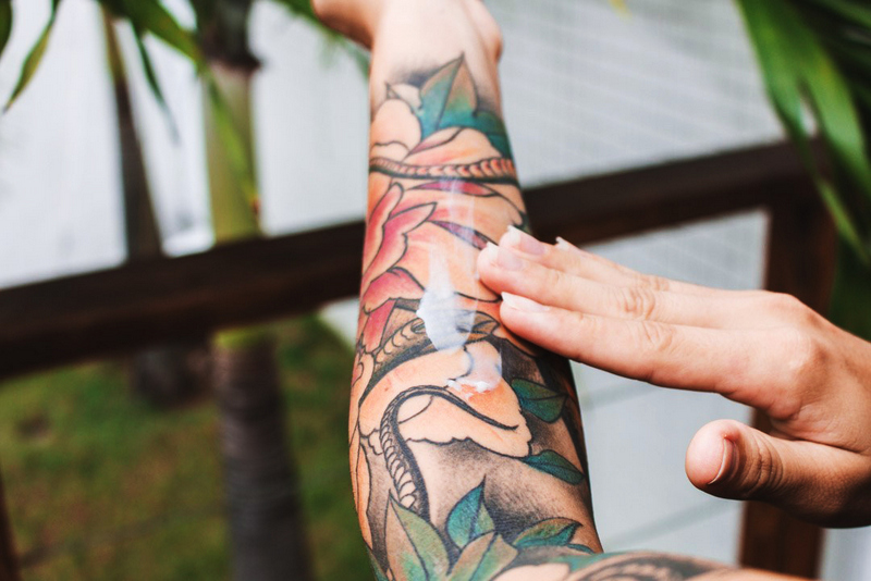 Remover tatuagem está cada vez mais fácil e menos dolorido; entenda a técnica