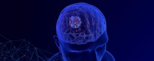 É possível viver bem após um tumor cerebral? Neurocirurgião da UNICAMP explica