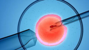 Entenda as principais tendências nas técnicas de reprodução assistida