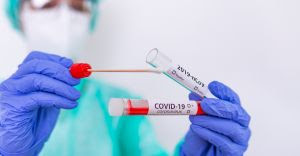 Pauta | Com mais de 10,2 milhões de testes de COVID-19 em 2020, setor privado foi responsável por 43,1% de todo o diagnóstico do país