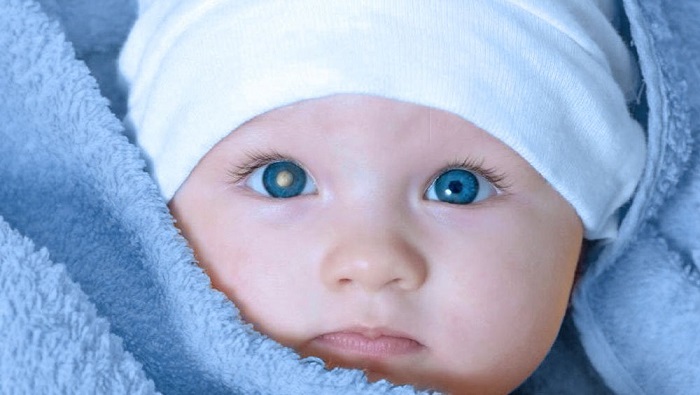 Câncer no olho do bebê pode passar despercebido