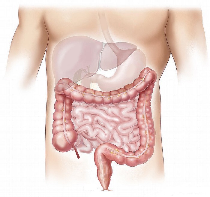 Setembro Verde traz alerta sobre o câncer de intestino