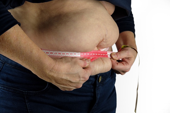 Cirurgia bariátrica ajuda combater a obesidades e as doenças associadas