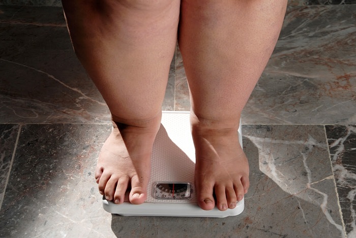 Mais de 40% dos brasileiros estarão obesos até 2035