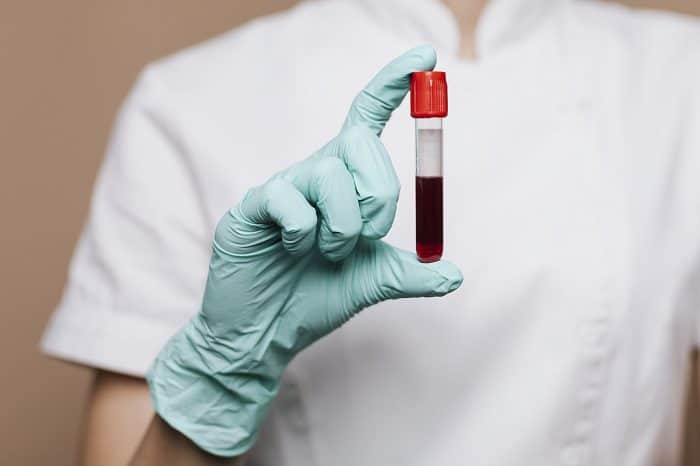 Jejum não é necessário para a maioria dos exames de sangue