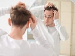 Uso de minoxidil e hipertricose em bebês: o que se sabe sobre essa relação